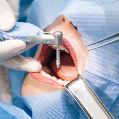 Main Gate Dental Clinic - Dental Surgeons